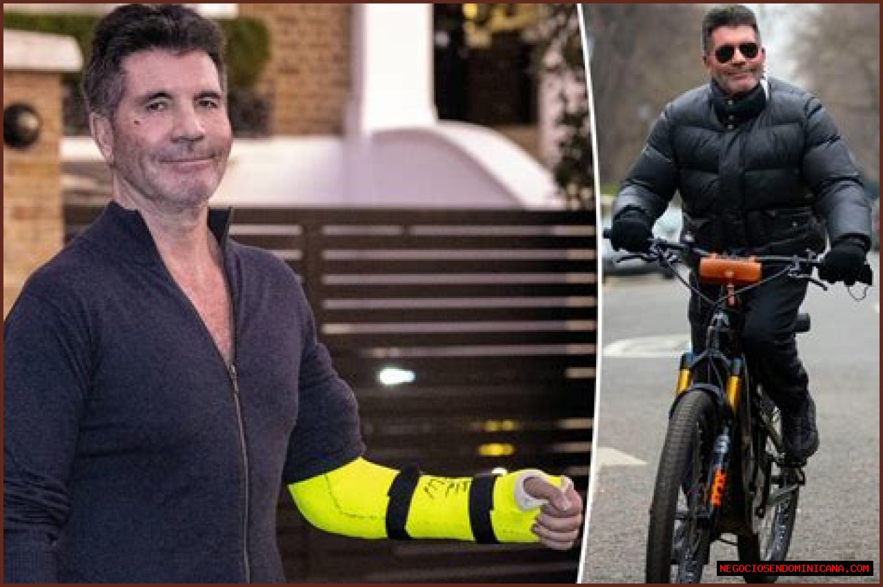 Simon Cowell Suffers Broken Arm After 2nd Bike Accident